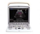 CHISON Q5 全數(shù)字彩色超聲診斷系統(tǒng)